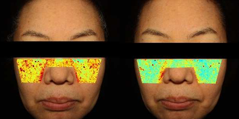 Improvement in outer and inner melanin by 29.97% after 2 weeks of use