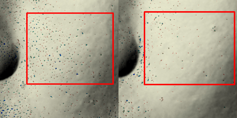 Decreased 3 pore-related indicators after 4 weeks of use (reduced pore depth by 12.68% / reduced pore size by 30.60% / reduced pore area by 40.85%)