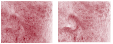 After a single use, improved heat stimulation by 14.57%