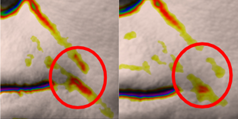 5.98% improvement in nasolabial wrinkles after 2 weeks of use