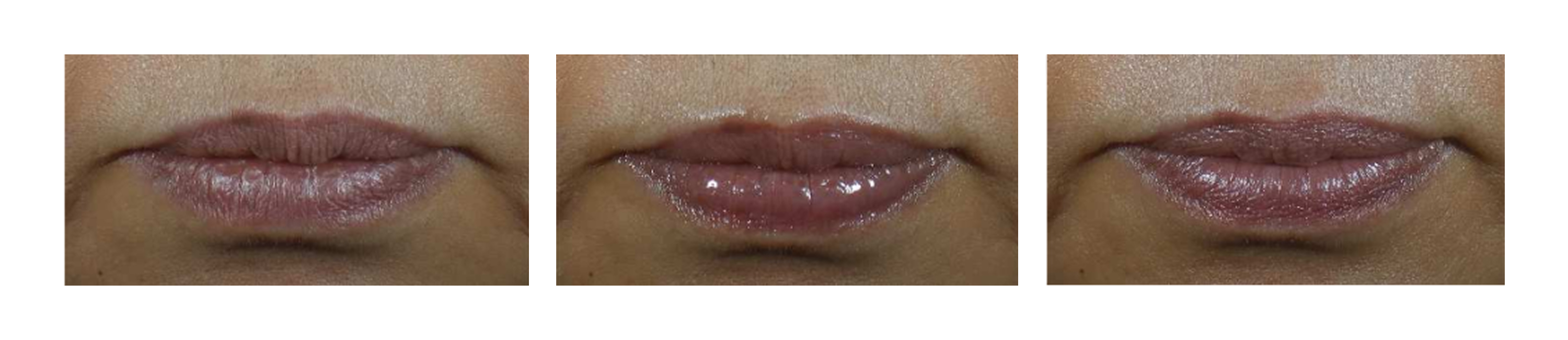 94% improvement in lip glow immediately after one use and 54% improvement in lip glow after 24 hours