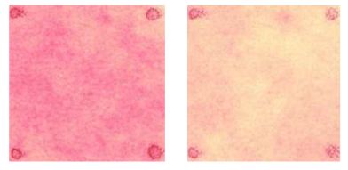 After single use of PDRN cream, improved skin calming and redness by 24%