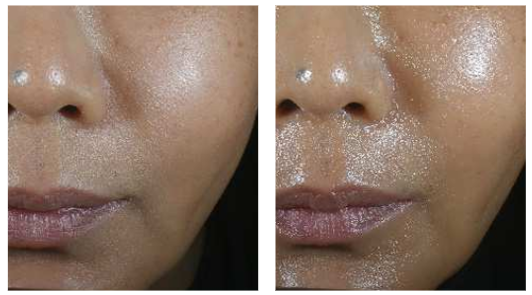 After a single use, improved skin glow by 41%